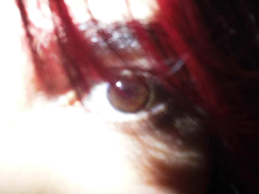 Me!